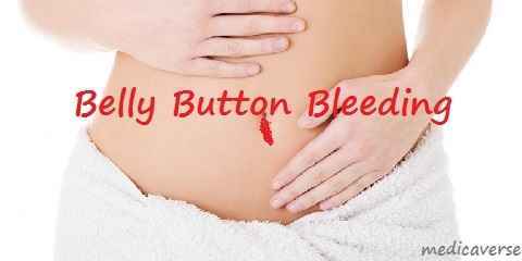 belly button bleeding