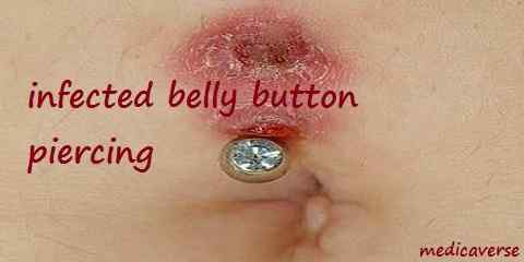 belly button problem pain infection bleeding swollen rash stinky leaking discharge