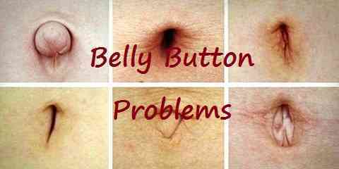 belly button problems